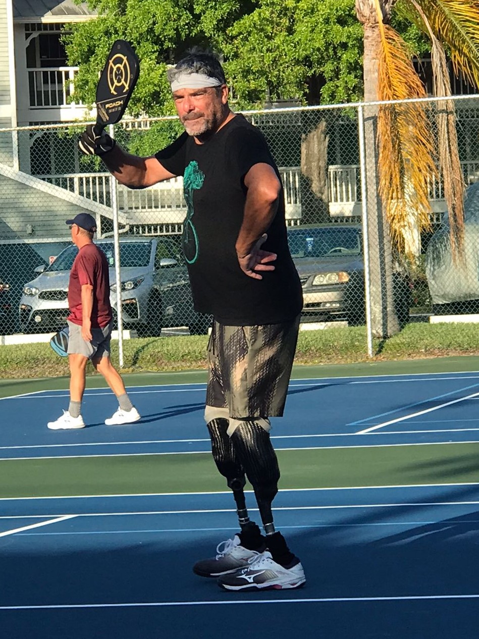 pickleball for amputee
